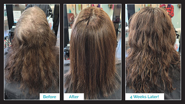 Topper Hair Replacement Installation - Before & After