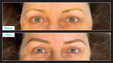 Eyebrow Microblading Before & After