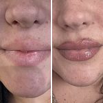 Ombre Lip Blushing Permanent Makeup - By Nada Toma
